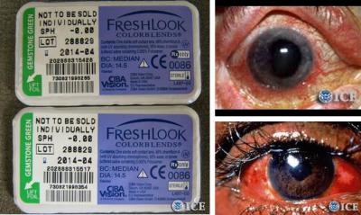 Federal authorities warn against dangers of decorative contact lenses